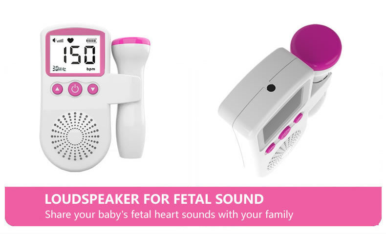 🩺IMEX DOP-Tone II Fetal Doppler Ultrasound Monitor 🤲Guard Your Baby’s Health – Hear Every Heartbeat🎀